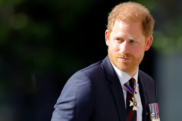 Prince Harry baldness